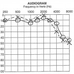 Audiogram